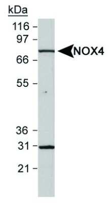 Western Blot: NOX4 Antibody [Biotin] [NB110-58851B] - Detection of NOX4 in human kidney lysates uisng NB110-58851 at 0.5 ug/ml. Band observed at 31 kDa may represent reported splice isoform.